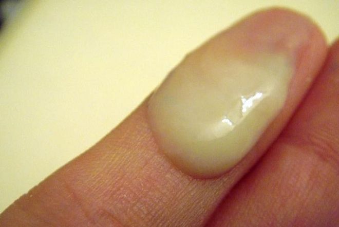 khí hư ra nhiều có màu xanh trong ngày rụng trứng
