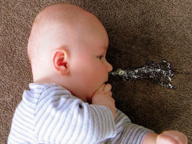 trào ngược dạ dày thực quản dễ khiến trẻ sơ sinh bị viêm phổi