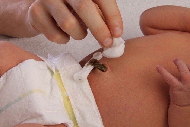 mẹ cần chăm sóc rốn của bé đúng cách
