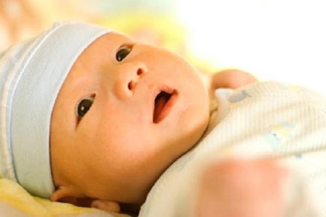 da của trẻ sơ sinh 1 tuần tuổi khá vàng