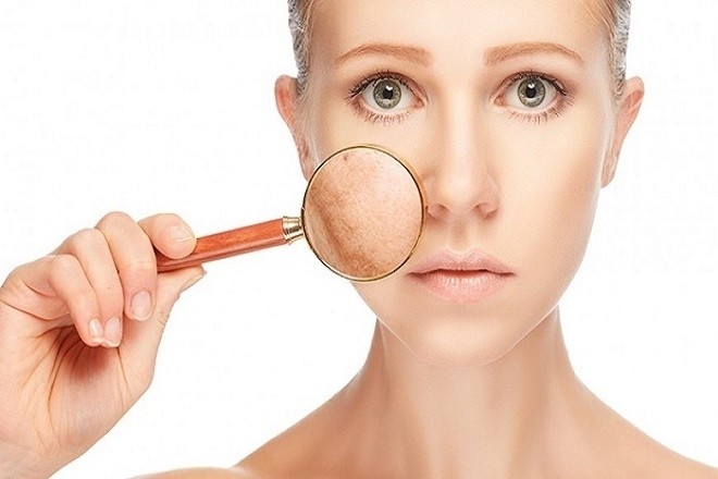 Da xấu đi dấu hiệu đầu tiên của mang thai