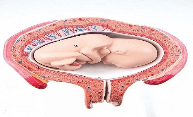 ngôi thai ngược dẫn đến khó sinh