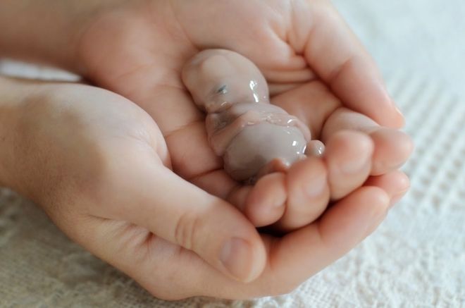 Sẩy thai khiến mẹ bị chảy máu kèm theo triệu chứng chuột rút, đau bụng dưới