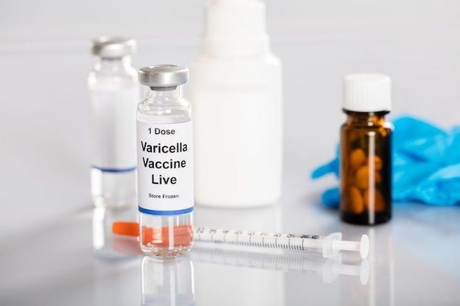 vắcxin varicella
