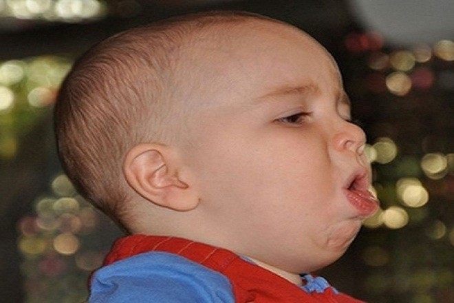khi trẻ sơ sinh bị ho có đờm vàng hoặc xanh cần đưa trẻ đi gặp bác sĩ ngay
