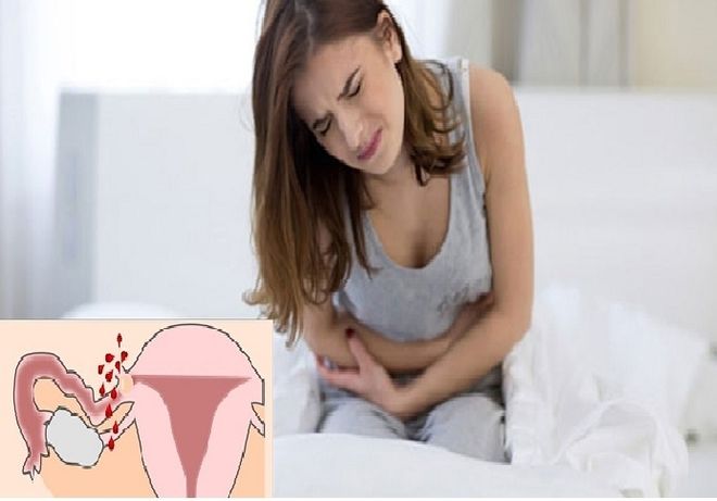 dấu hiệu có thai ngoài tử cung
