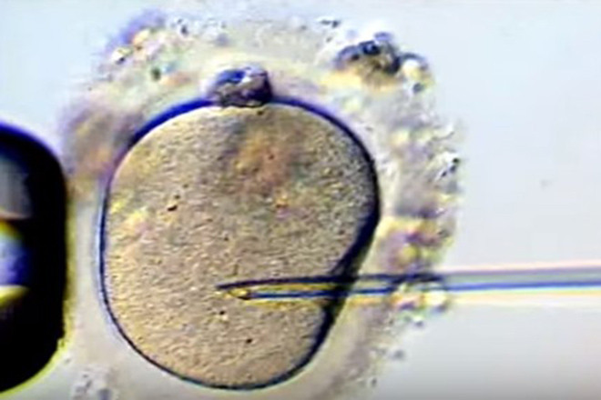 Thu tinh ống nghiệm IVF