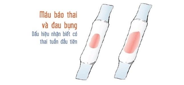 Máu báo có thai