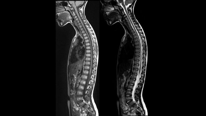 chụp MRI