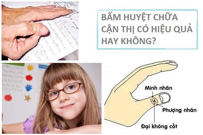 Phương pháp bấm huyệt chữa cận thị