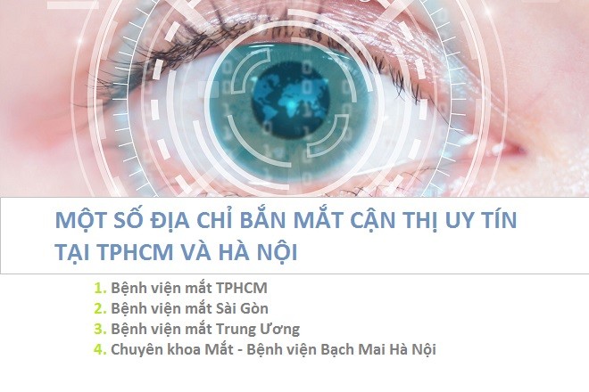 bắn mắt cận thị ở đâu uy tín