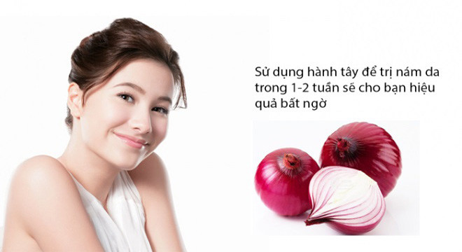 Trị nám da sau sinh bằng hành tây