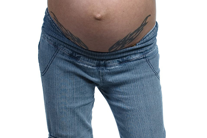 Rốn lồi cũng khiến mẹ bầu dễ đau rốn