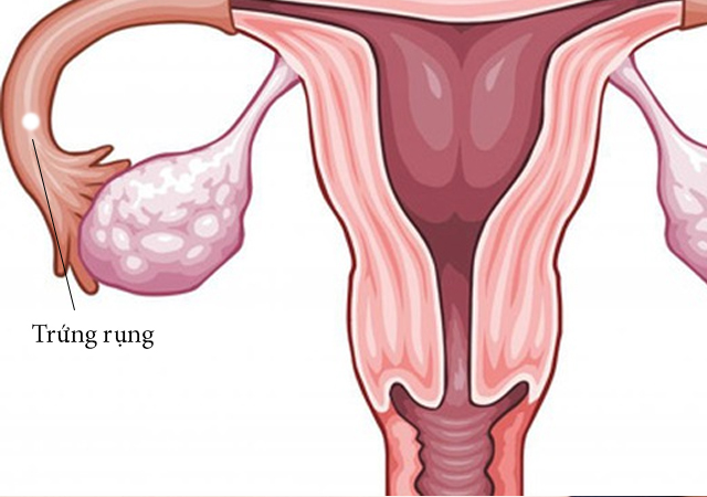 trứng rụng