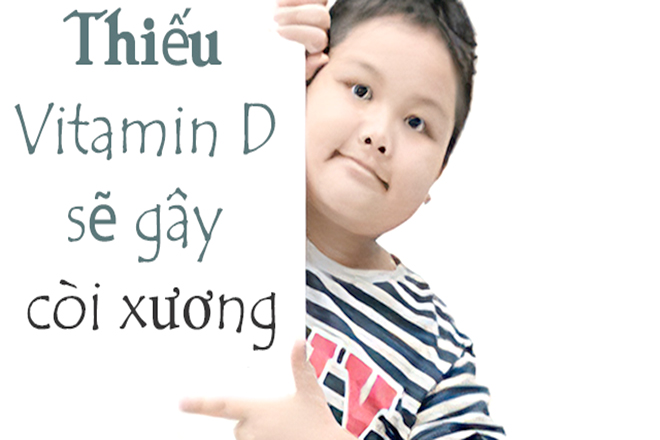 Thiếu Vitamin D gây ra còi xương