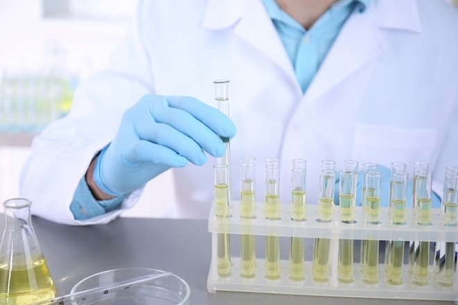 xét nghiệm nước tiểu