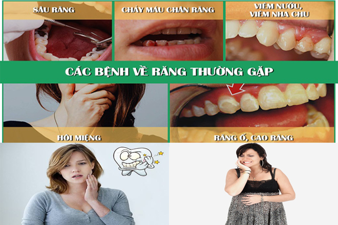 tình trạng răng miệng của bà bầu