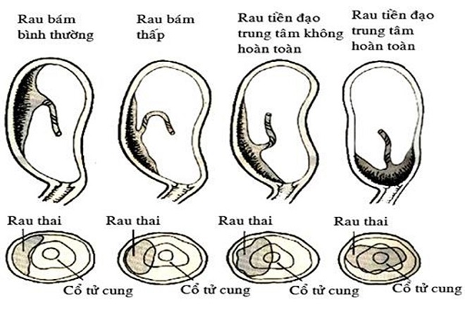 phân loại bệnh