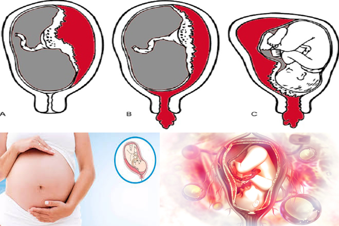 dấu hiệu nhận biết nhau tiền đạo