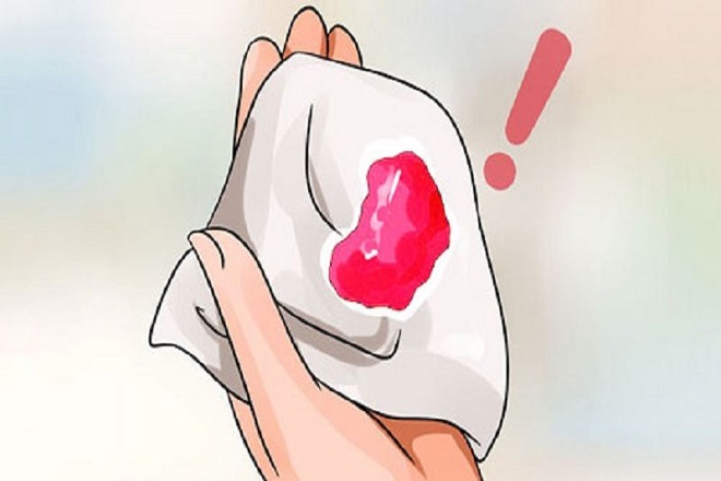 ra máu có nhiều nguyên nhân