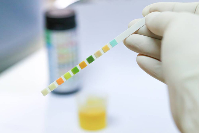 Xét nghiệm nước tiểu