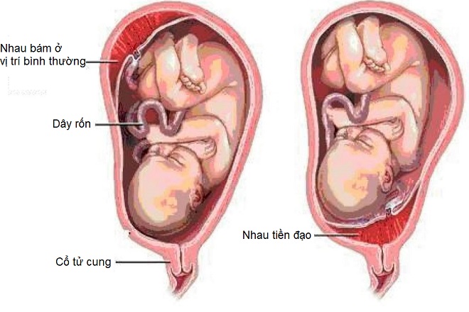 Nhau tiền đạo