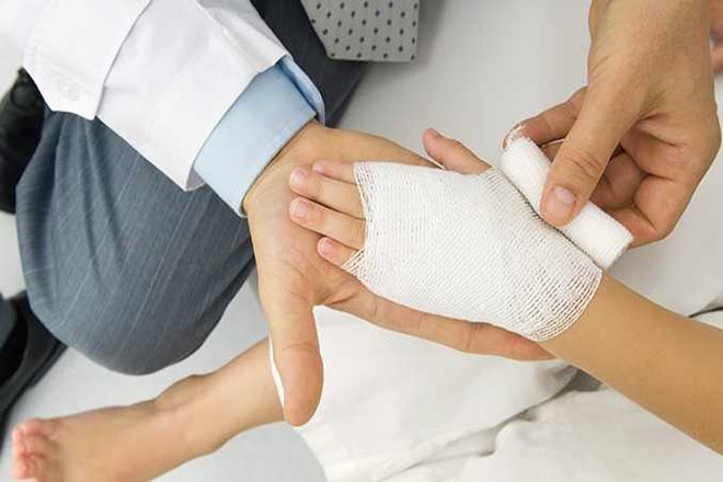 Trẻ bị bỏng nhẹ