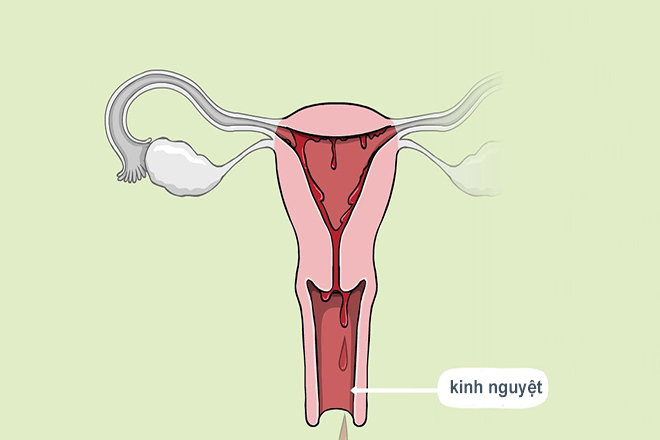 Kinh nguyệt xuất hiện