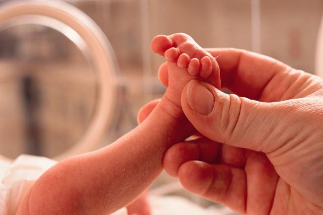 sinh non dễ bị vàng da