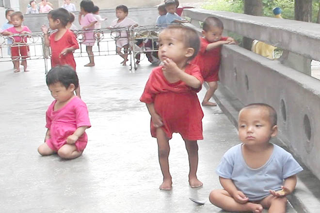 Trẻ em còi xương suy dinh dưỡng