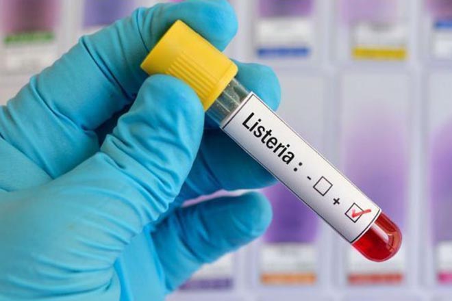 Nhiễm khuẩn Listeria
