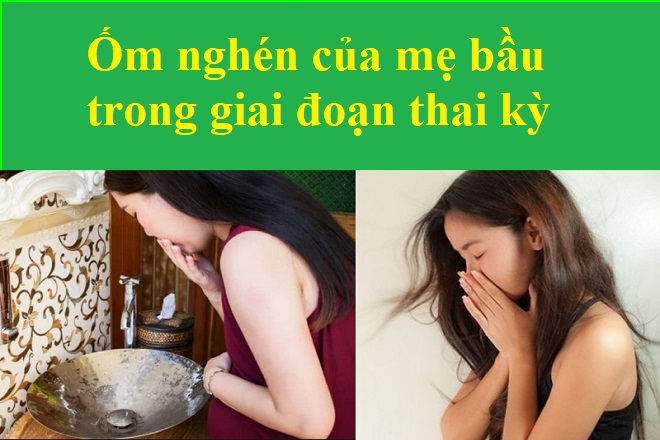 ốm nghén
