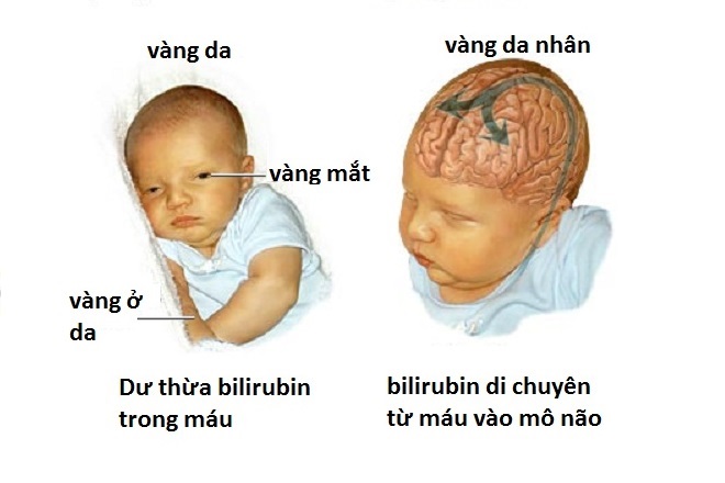 bien chung nguy hiem