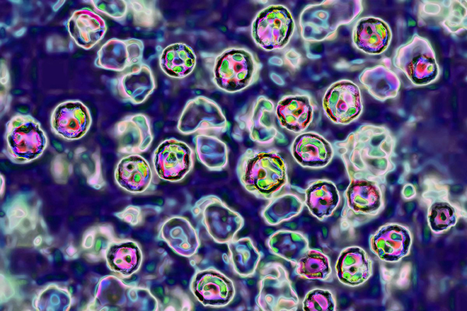 Bệnh sởi do virus lây lan