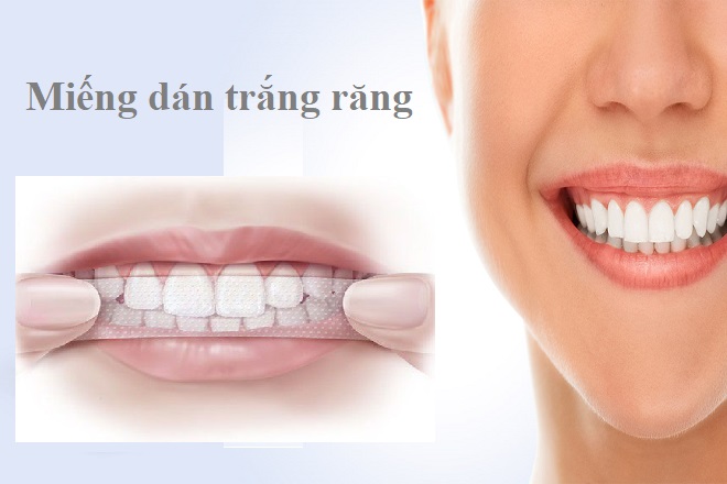 miếng dán trắng răng