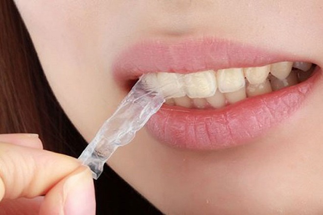 miếng dán trắng răng