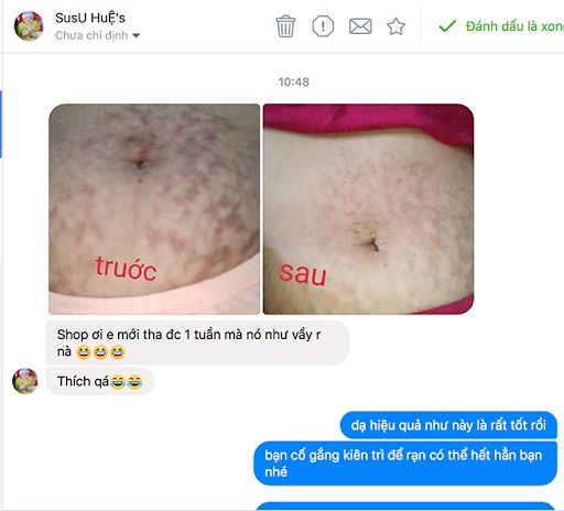 hinh anh sau khi dung kem ran da bemum