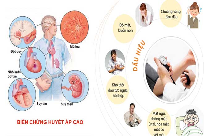 nguyên nhân và biến chứng