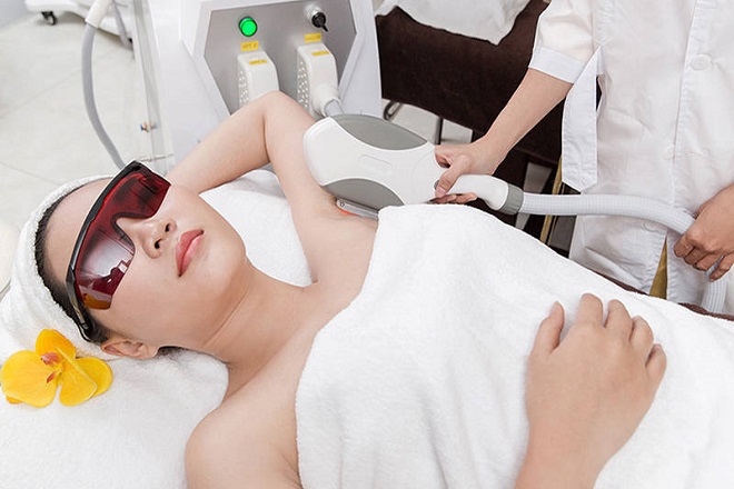 Phương pháp triệt lông vĩnh viễn bằng công nghệ OPT