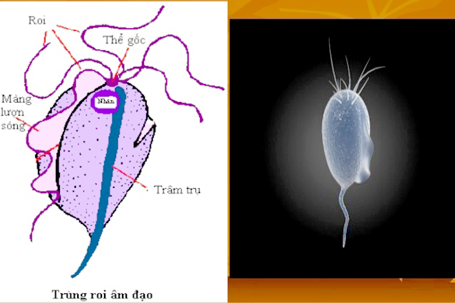 Trùng roi Trichomonas