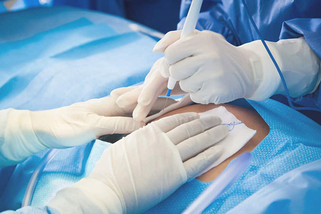 Sinh mổ là một cuộc đại phẫu