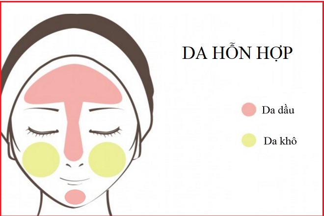 da hỗn hợp