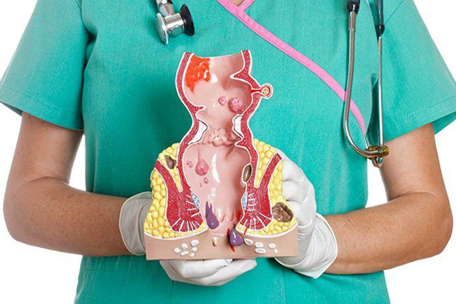 Trĩ có thể khiến bạn bị chảy máu