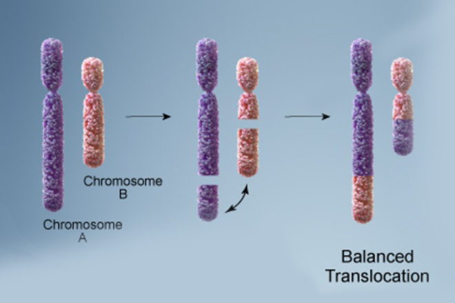 Balanced translocation