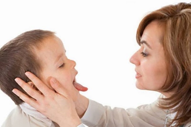 bé bị nhiệt miệng
