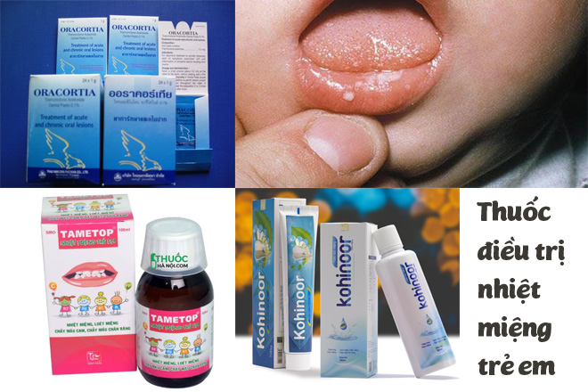 thuốc điều trị nhiệt miệng