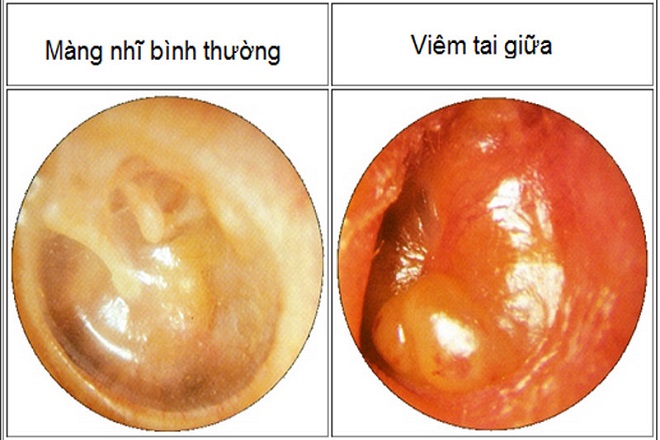 dấu hiệu