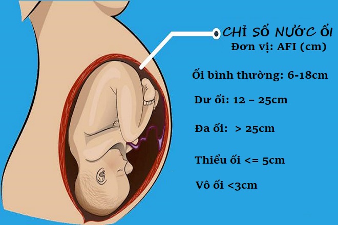 thông số