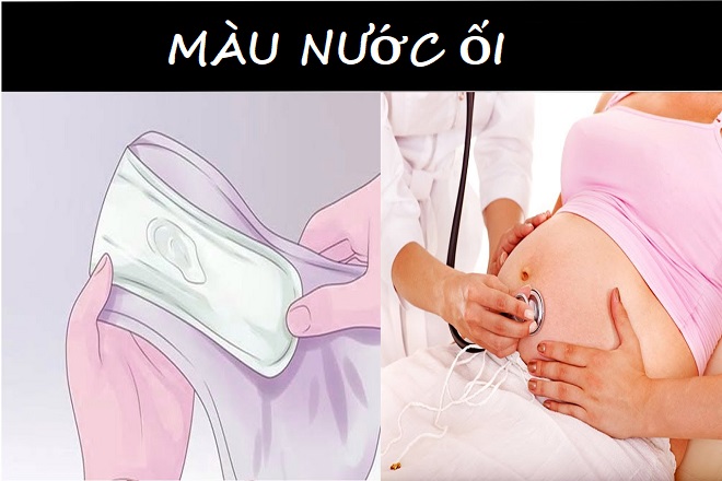 nước ối màu gì