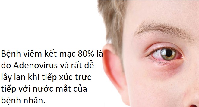 đau mắt đỏ